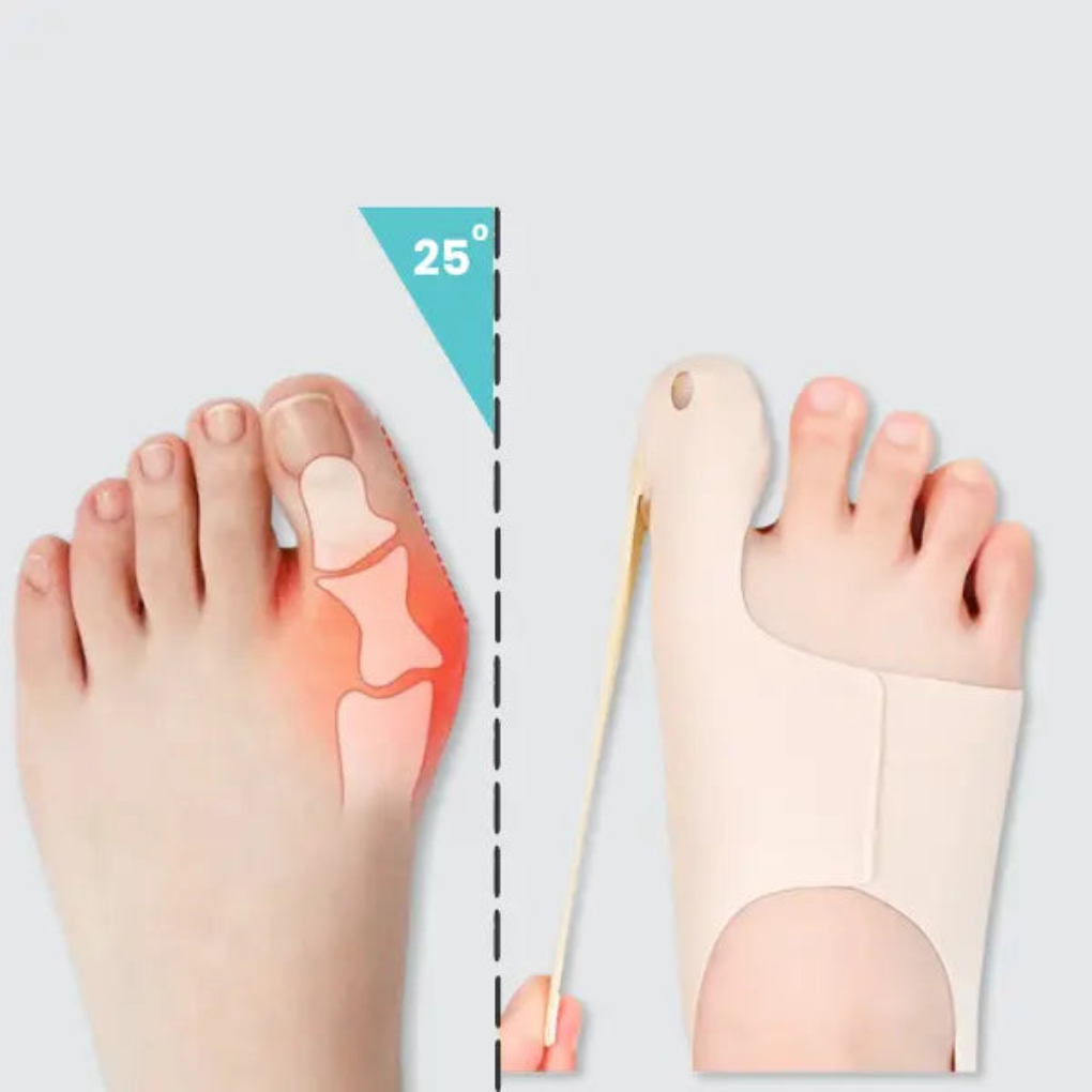 Hallux Corrector Sleeve
