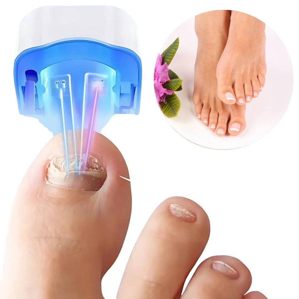 "Nagelpilz-Lasergerät für schmerzfreie Anwendung, Nahaufnahme, modernes Design, fördert gesunde Nagelregeneration."