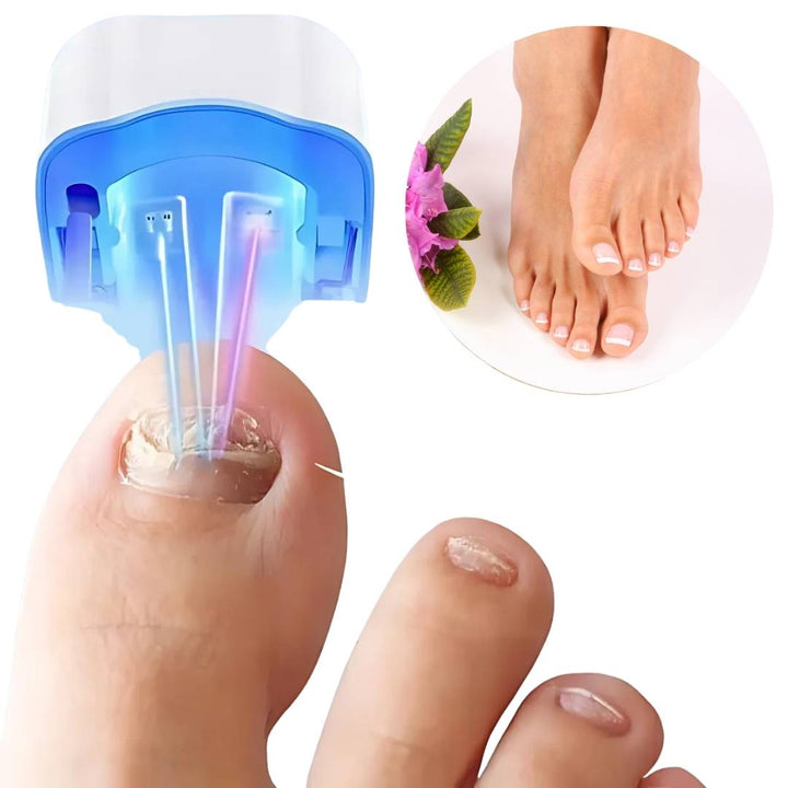 "Nagelpilz-Lasergerät für schmerzfreie Anwendung, Nahaufnahme, modernes Design, fördert gesunde Nagelregeneration."